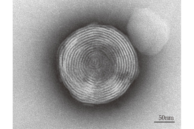 多重層リポソームの電子顕微鏡写真
