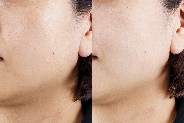 左から：すっぴんの状態、ベースメイク完成後