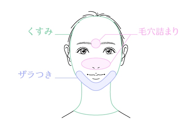 【アプローチ1】落とすケア